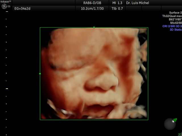 Luis Michel Fernandez-5