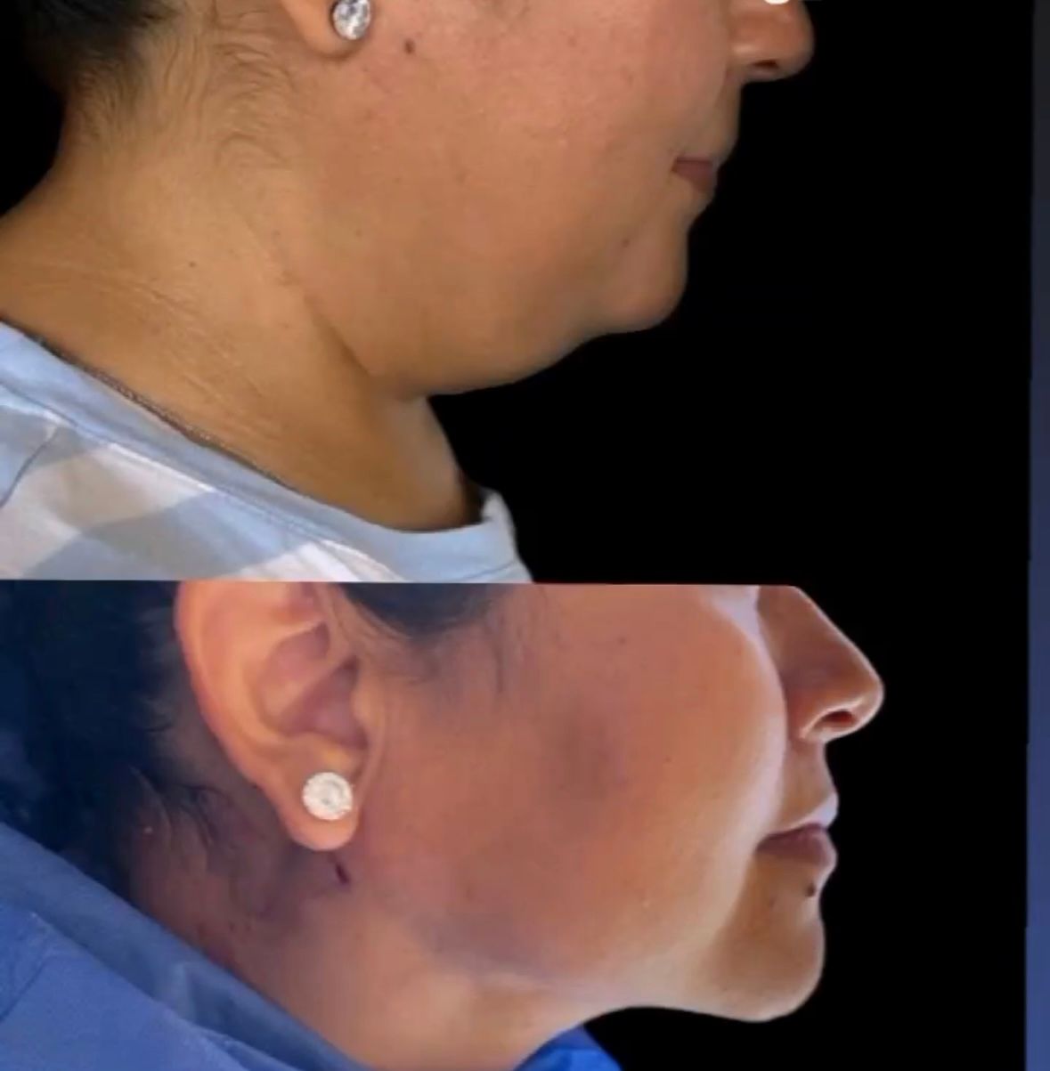 Nancy Valeria Lara Gayosso-18