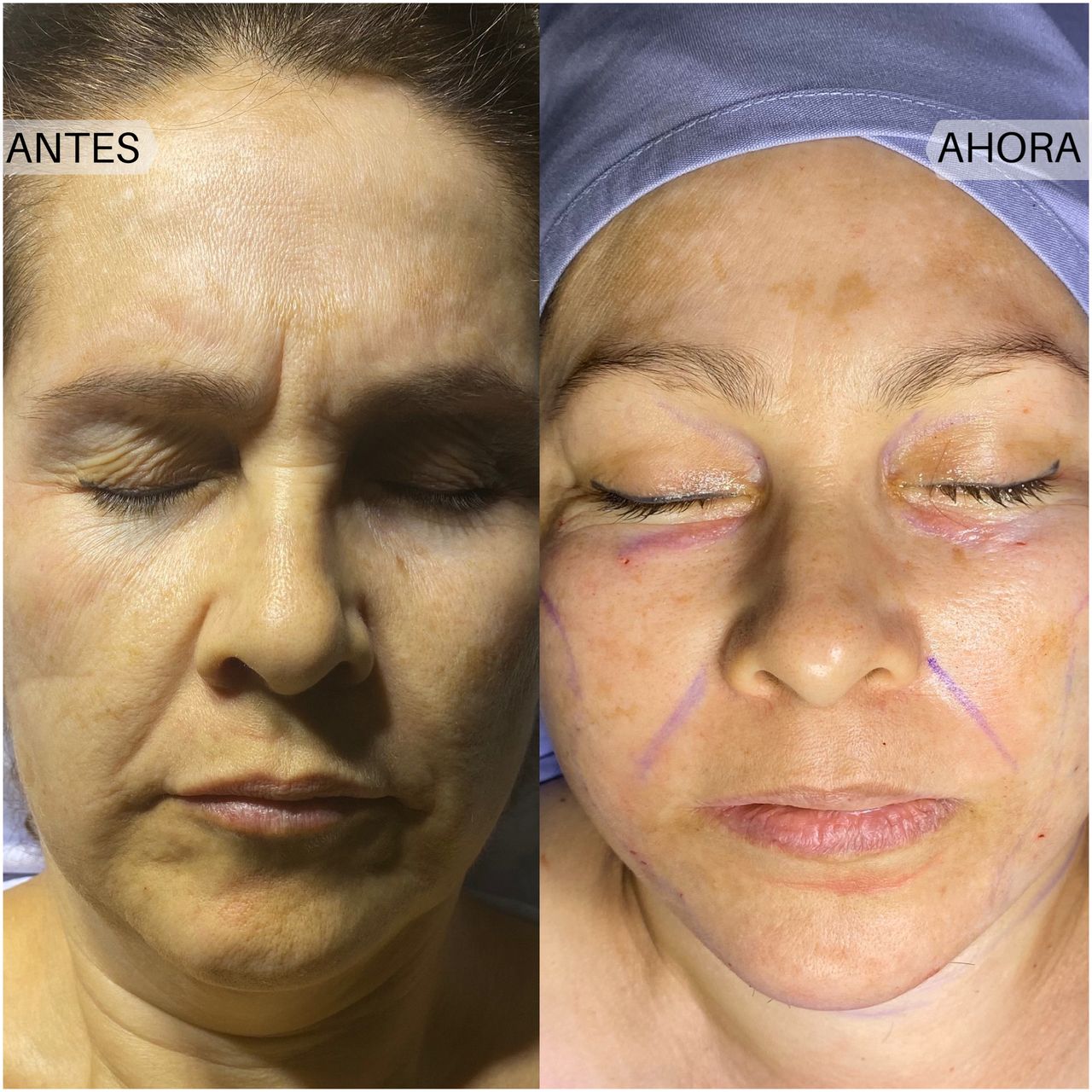 Luis Atilio Gil Pérez-11