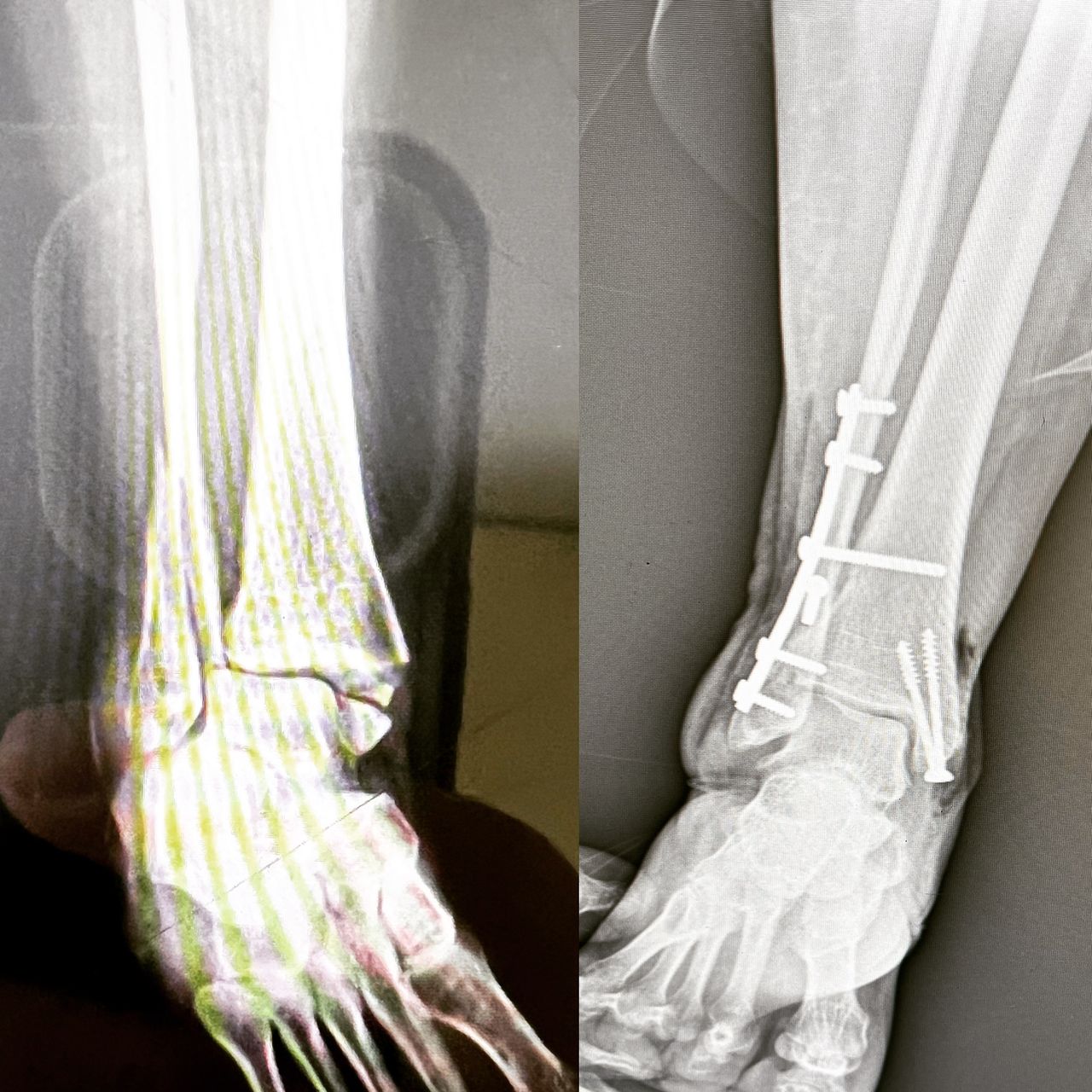 Luis Alberto Monge Bravo-10