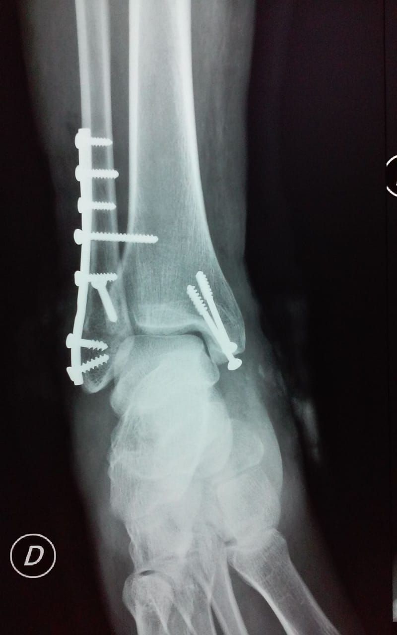 Eduardo Mondragón Marín-2