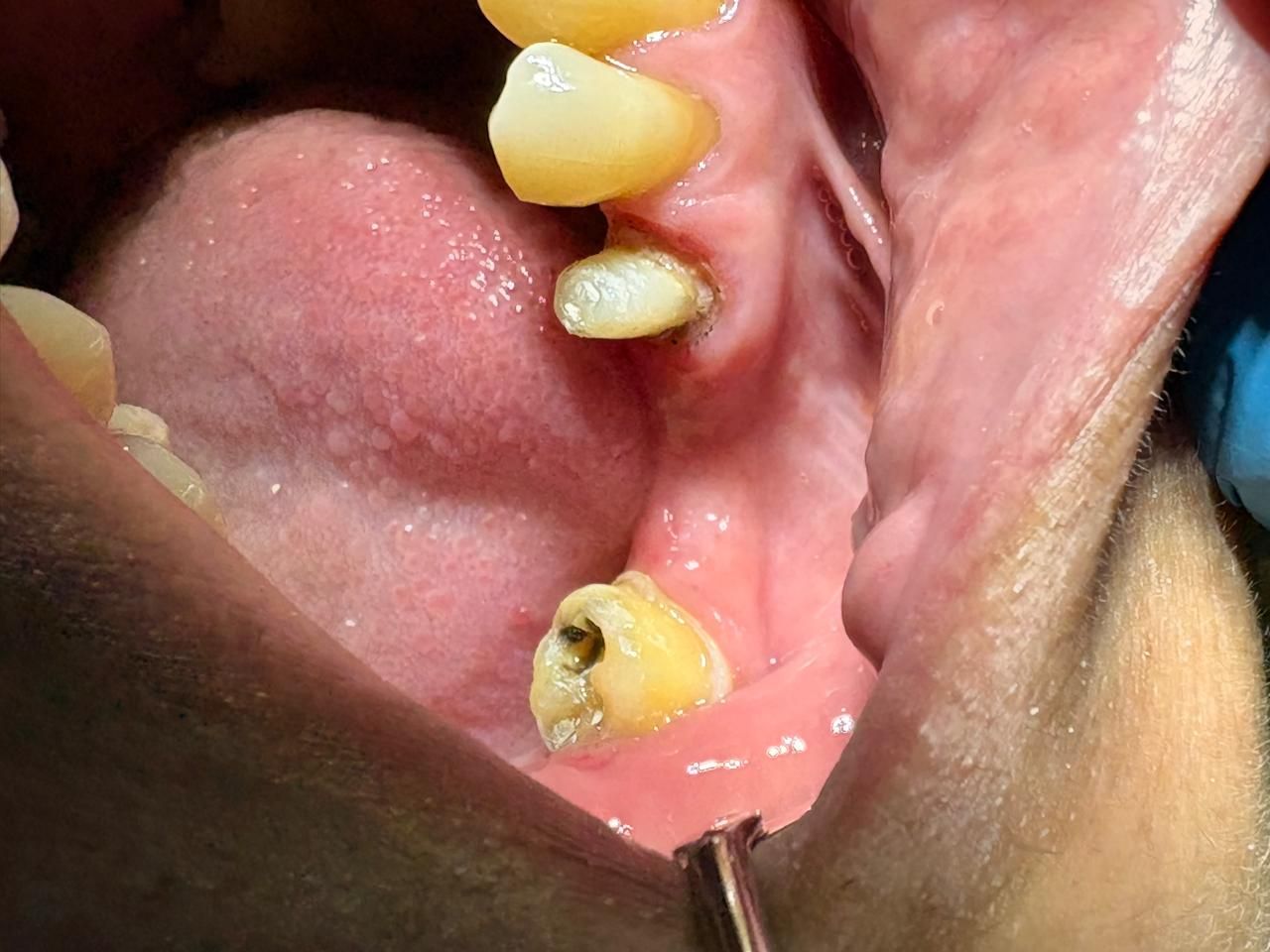 Arturo Romero Grande-44