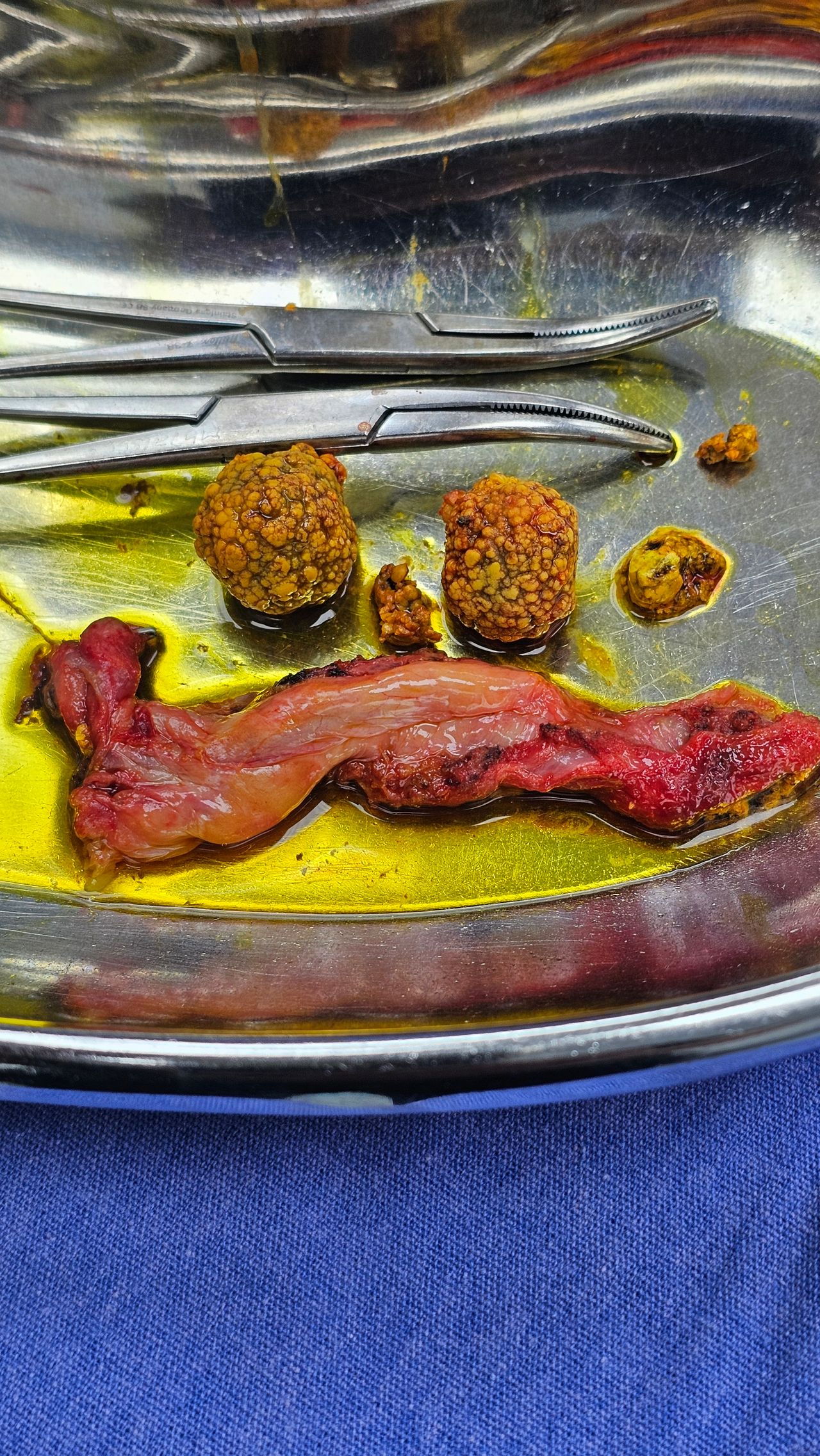 Nelson A. Saavedra Estrada-21