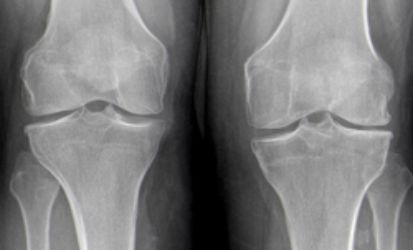 Lizeth Patricia Mena Rivas-21