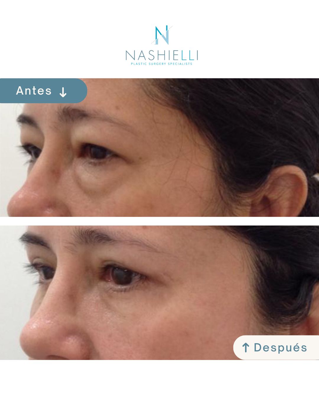 Nashielli Torres Espinosa Chiu-34