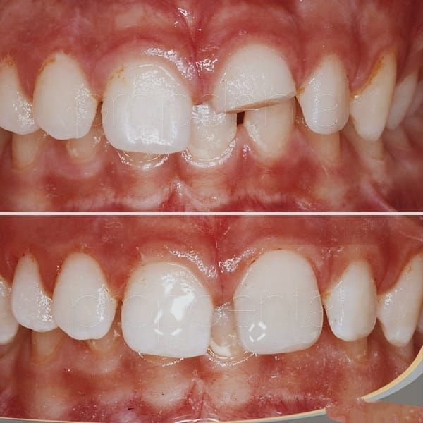 Pedro Badial Aceves-8