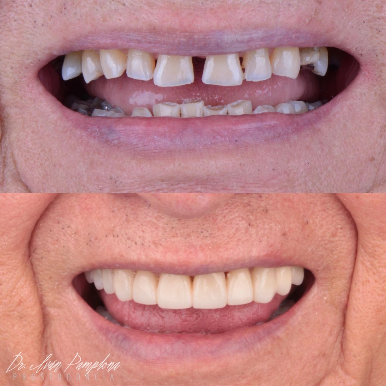 Iván Gerardo Pamplona Alfaro-4