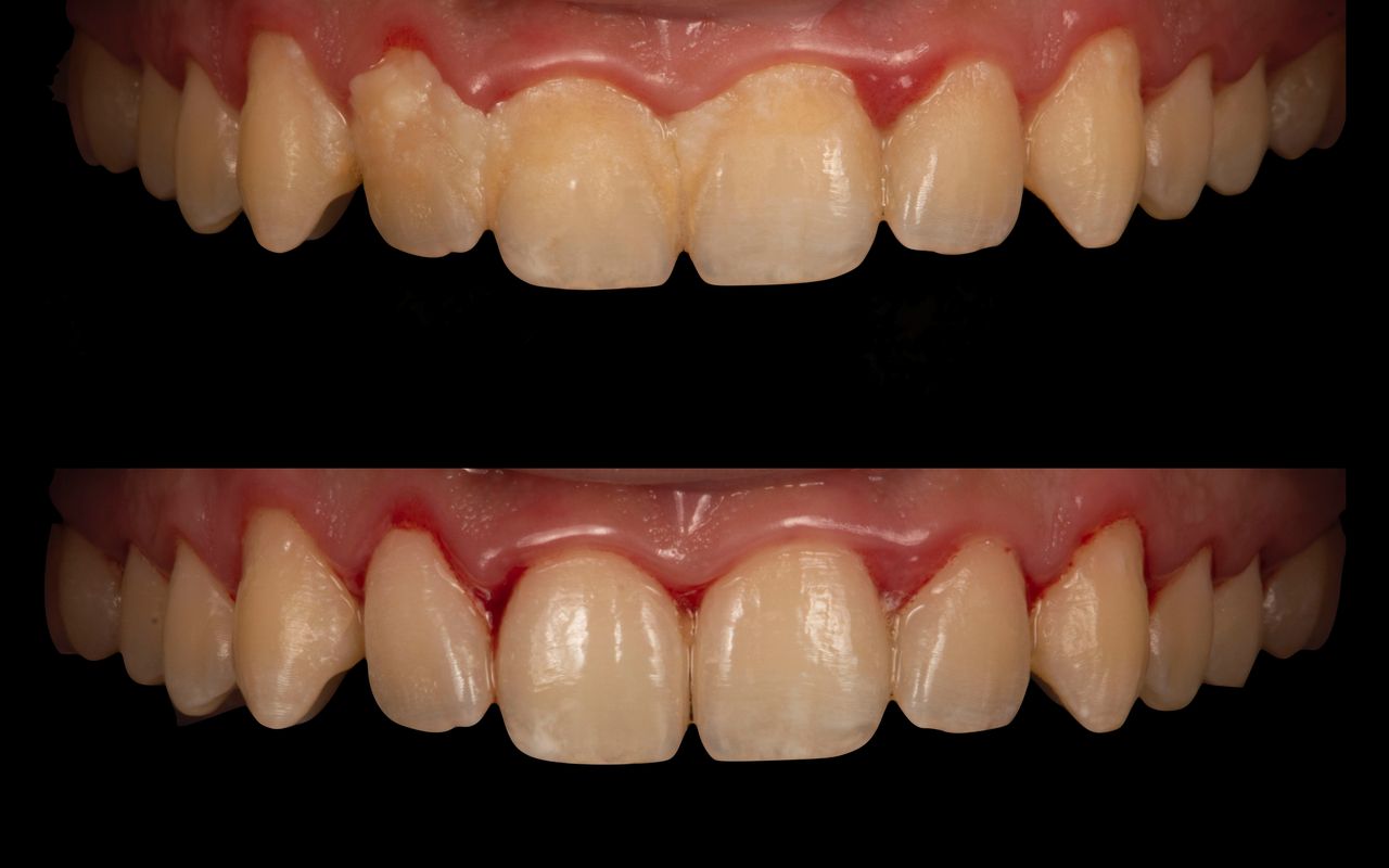 María Fernanda González Gastelum-68