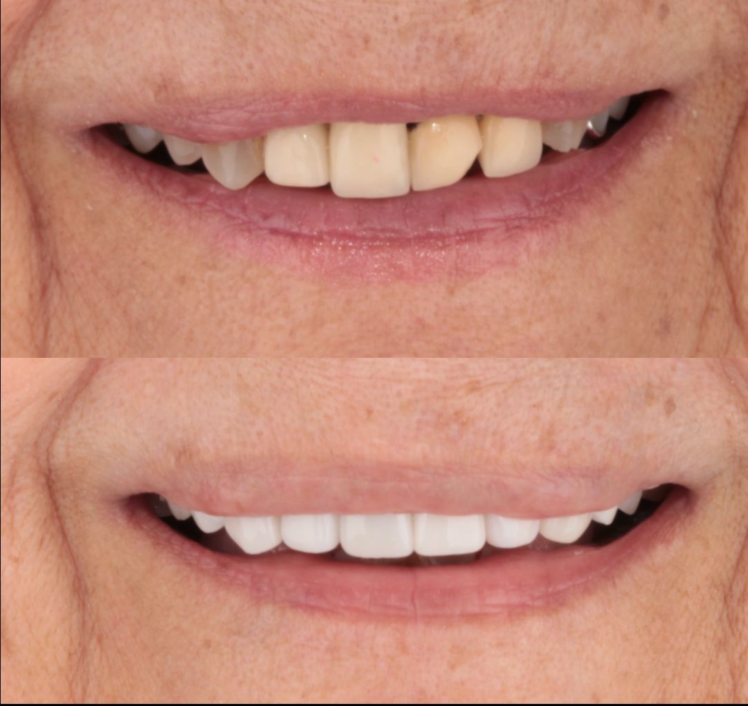 Aide Montserrat Orozco Gutierrez-22