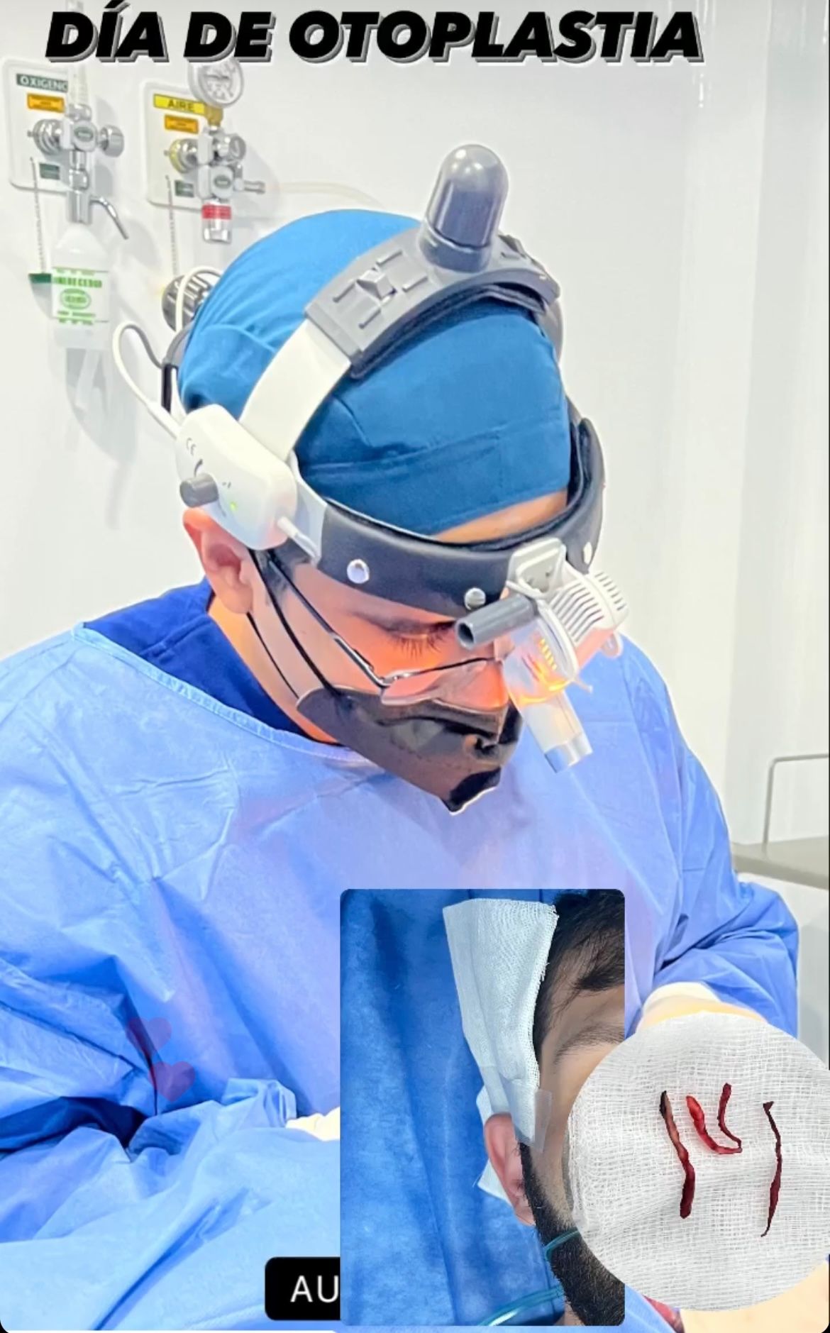 Axel Joffre Mora-240