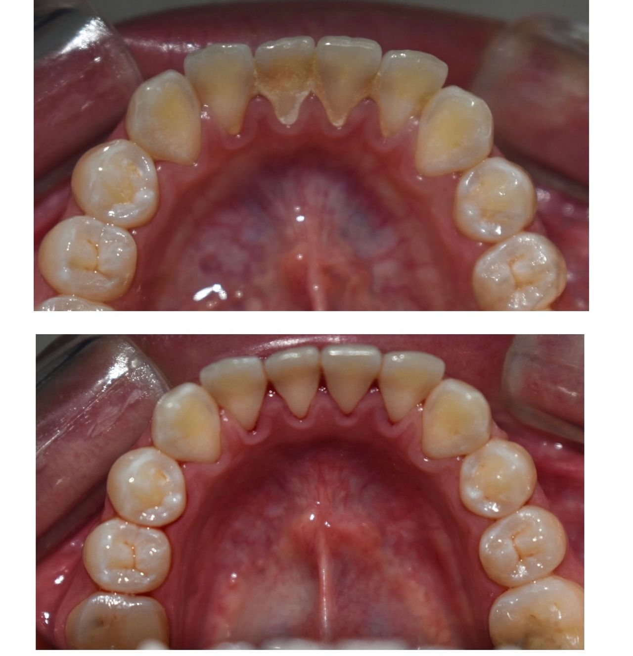 Andrea Moncada Rmz-24