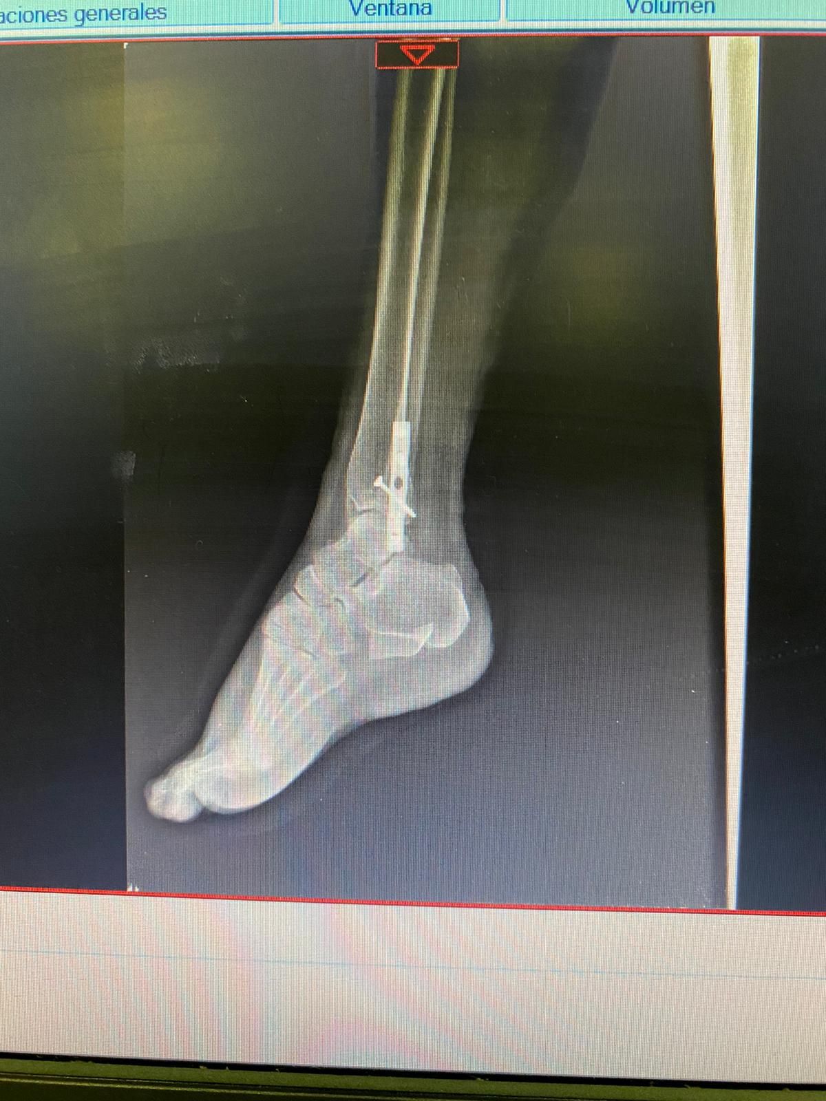 Juan José Luévano De La Cruz-41