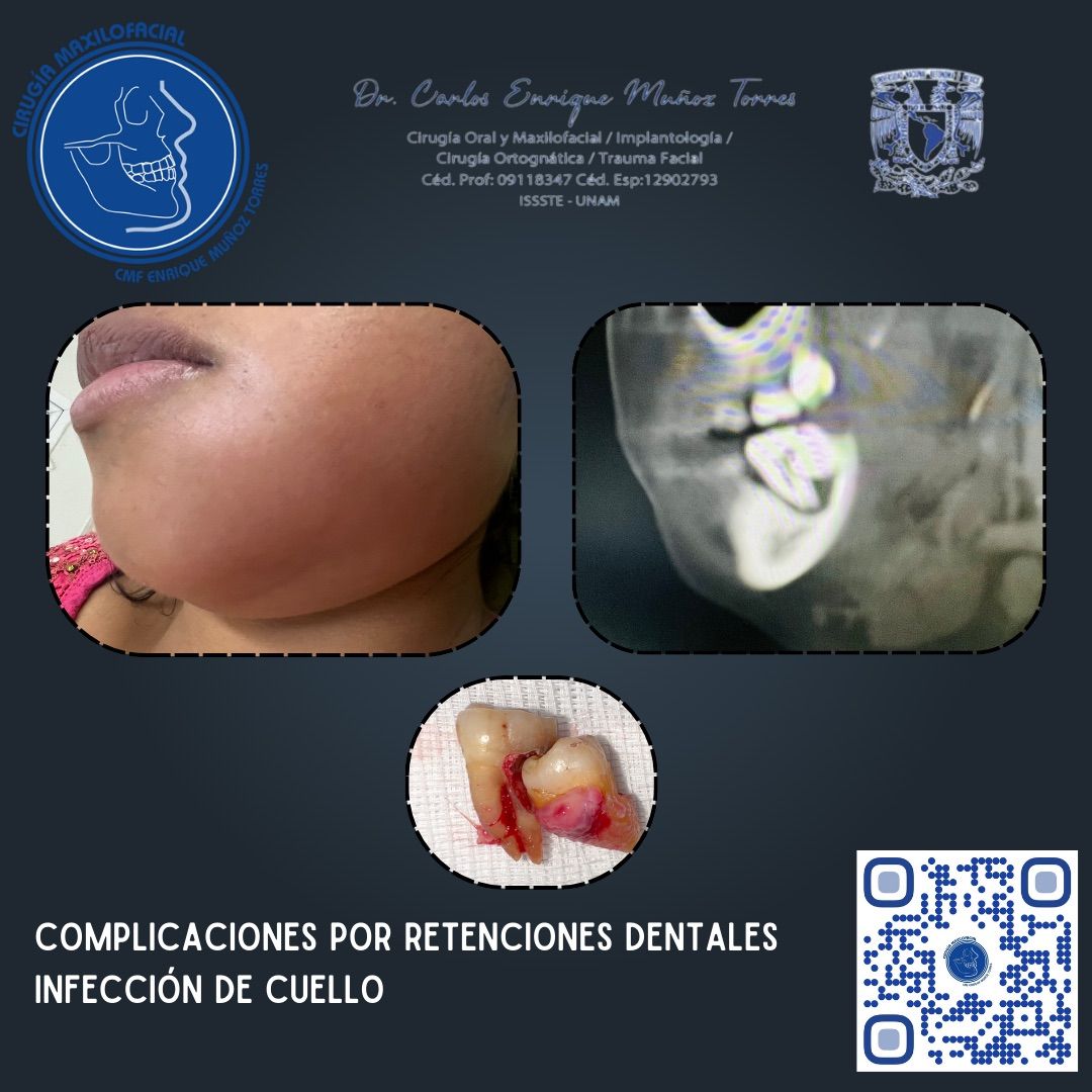 Carlos Enrique Muñoz Torres-15