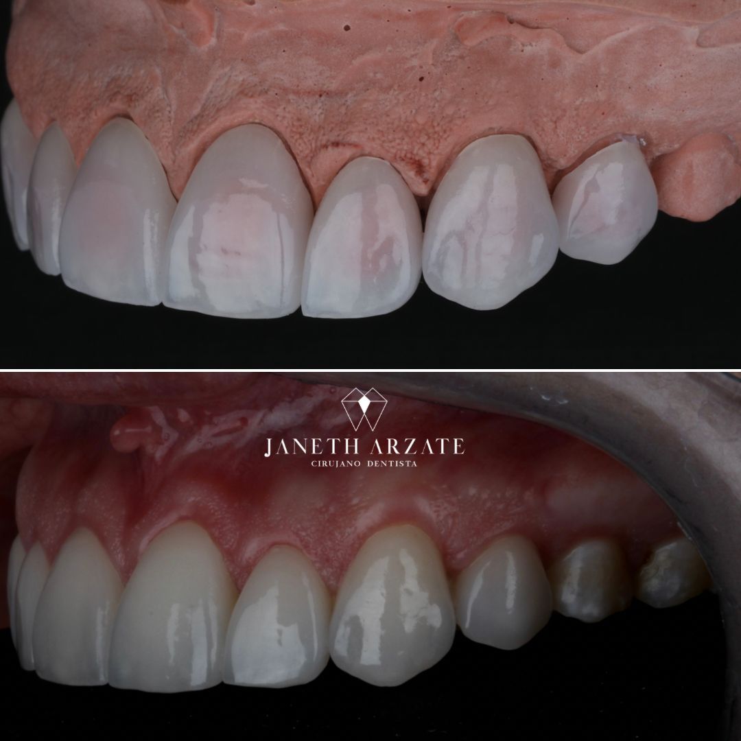 Janeth Arzate Banda-5