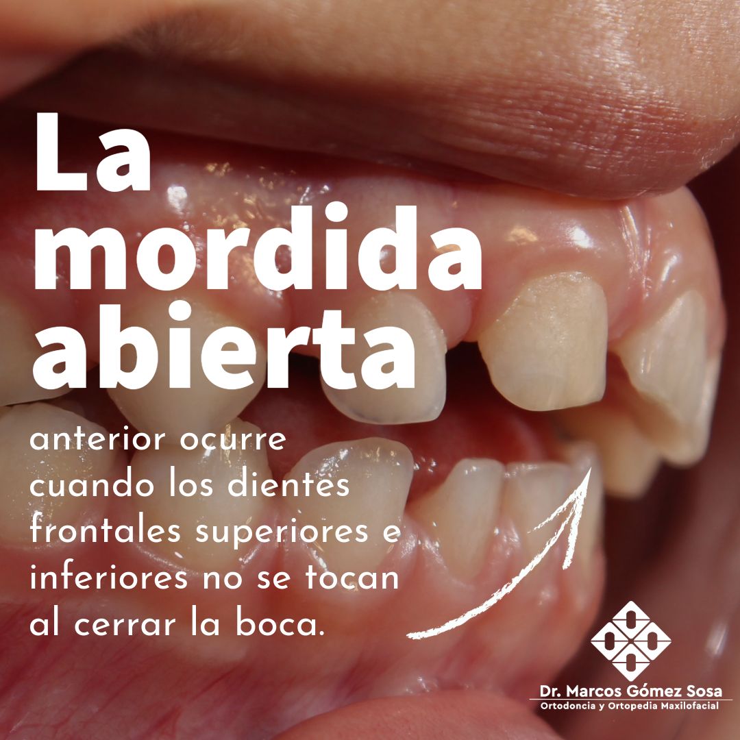 Marcos Gómez Sosa-43