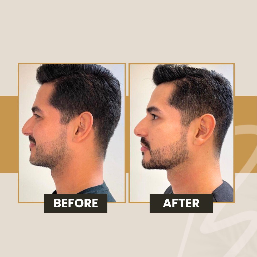 Gisel Areli Martinez Trejo-8