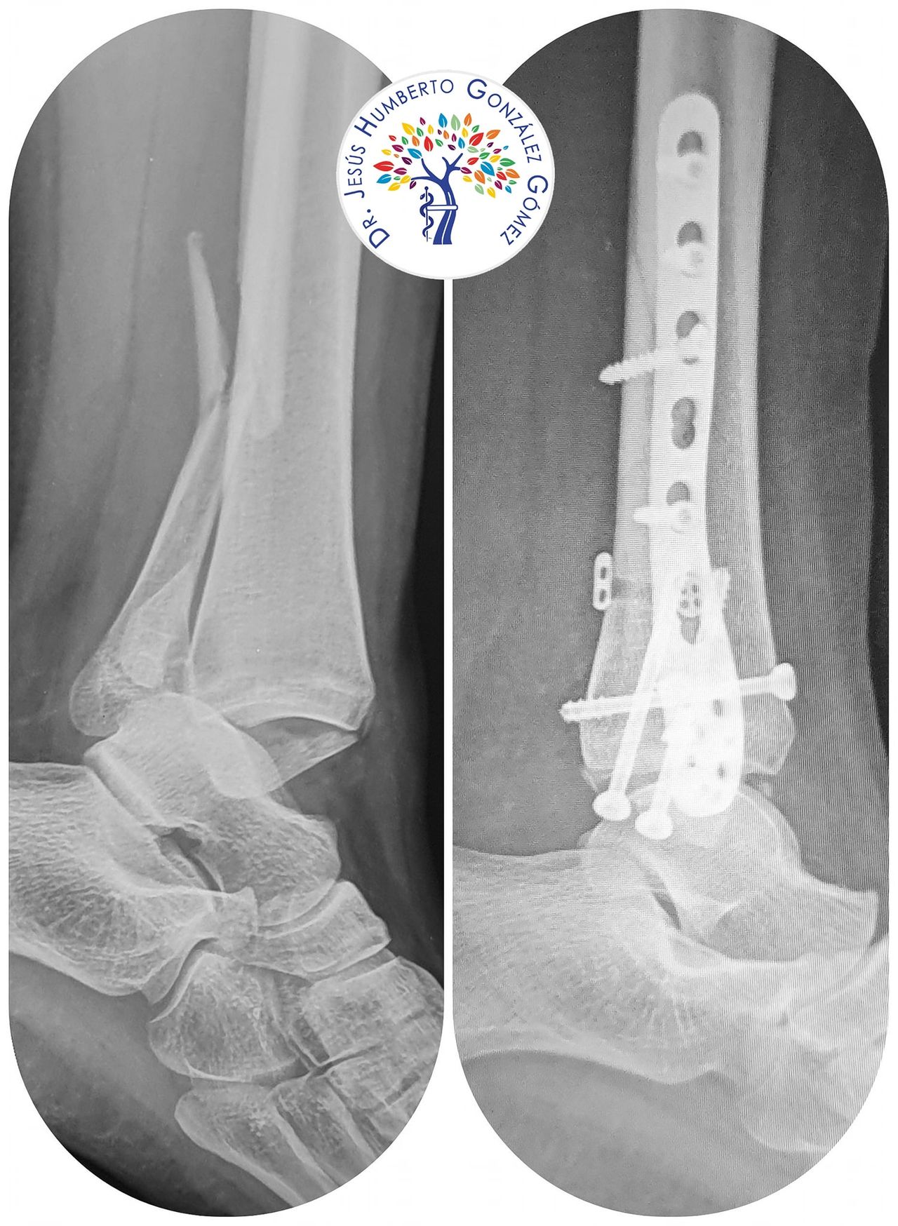 Jesús Humberto González Gómez-27