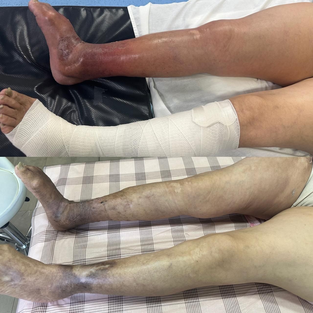 Jhonatan López González-35