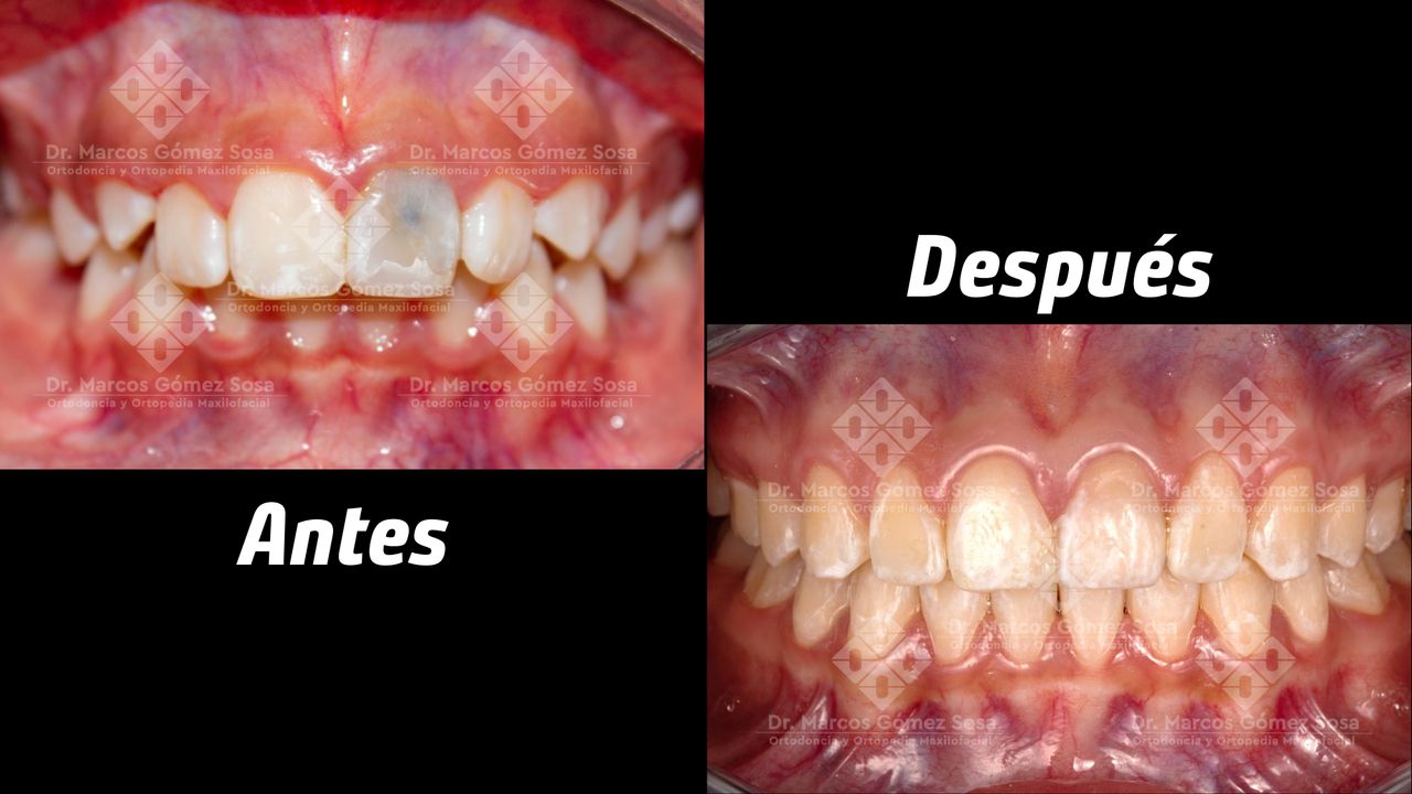 Marcos Gómez Sosa-6