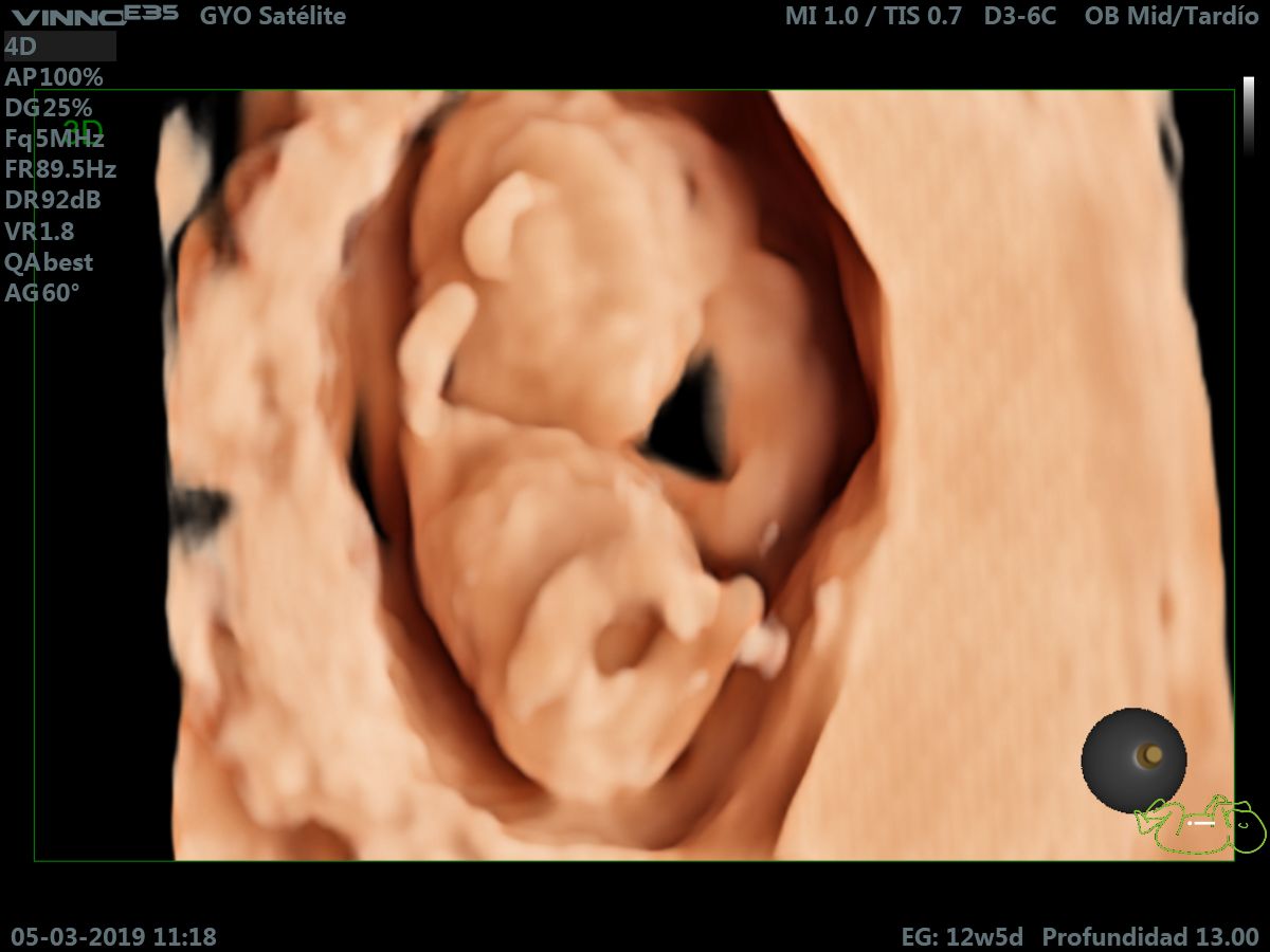 Giovanni Luis Tafelov Vindas-6