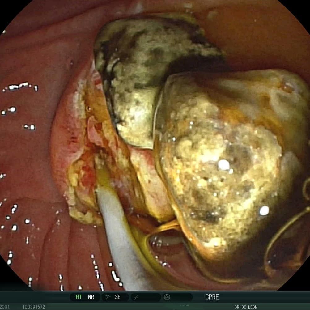 Edgar Alan De León Rojas-16