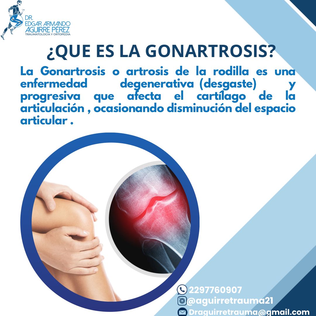 Edgar Armando Aguirre Perez-2