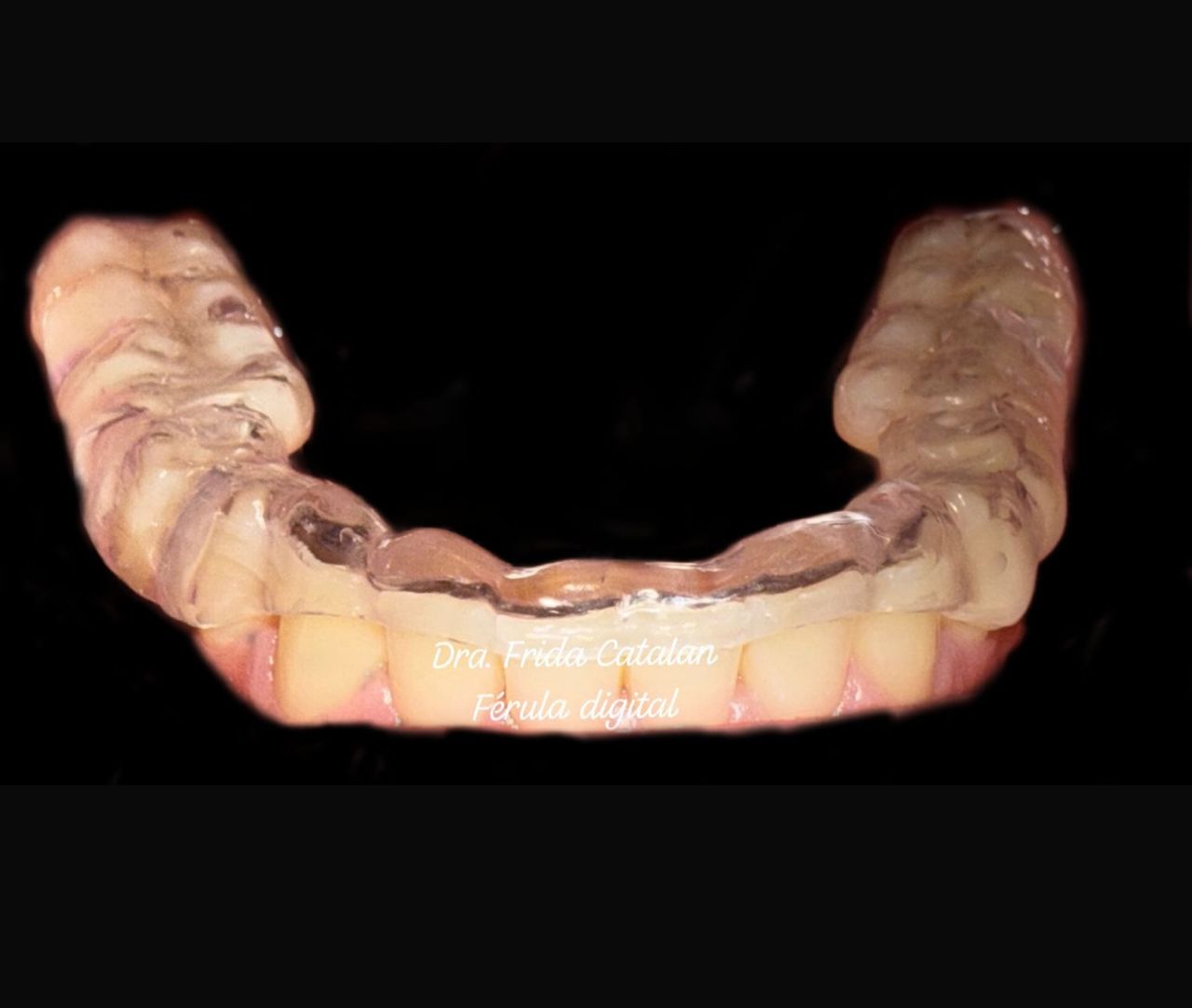 Frida Catalan Verdi-11