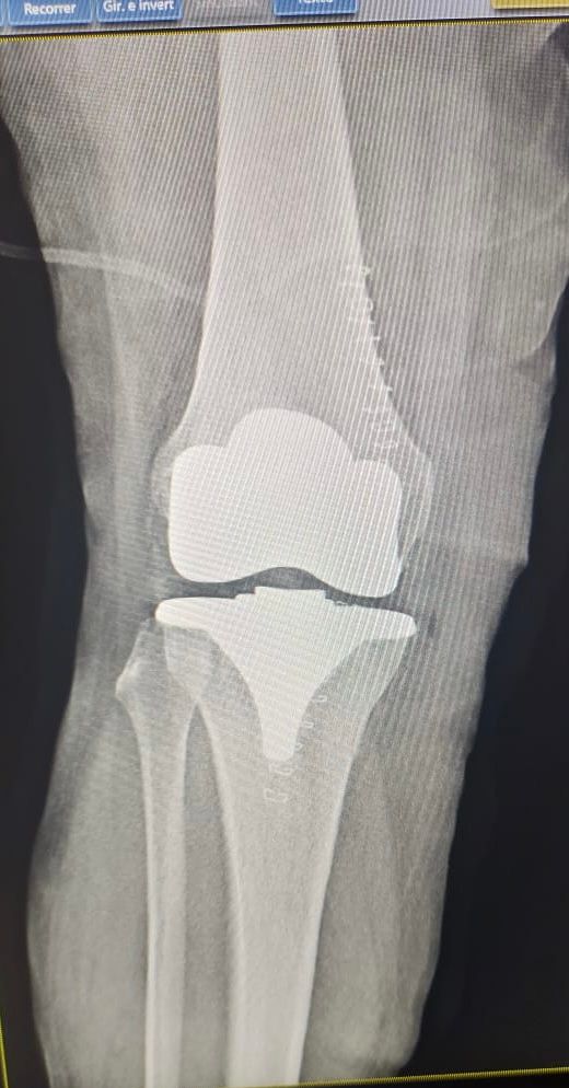 Josmar Adrián Lopez Eng-5