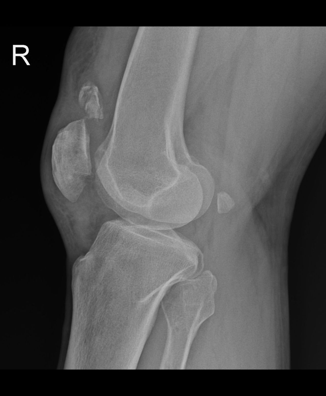 Carlos Humberto Vera Torres-8