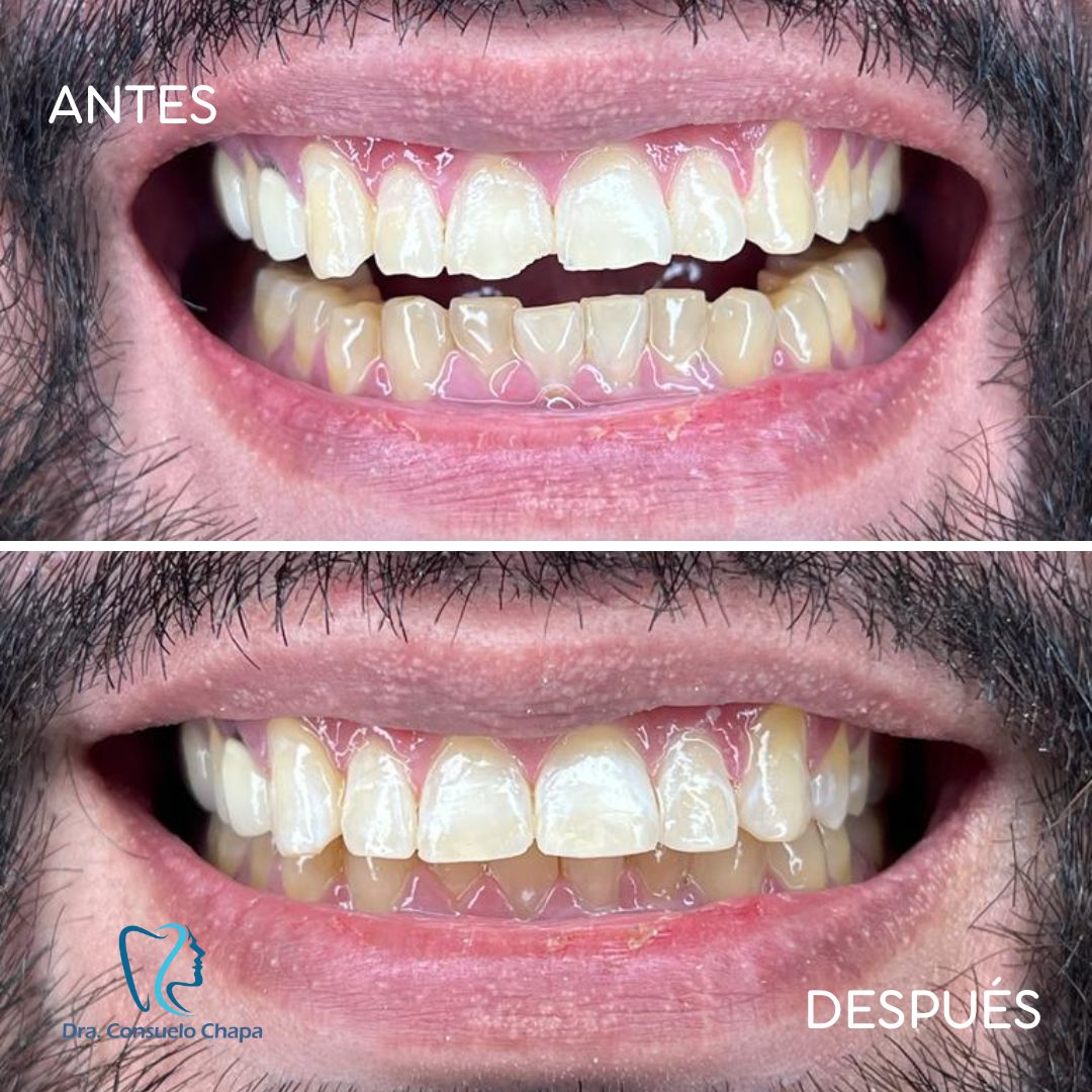 Consuelo Chapa Garza-1