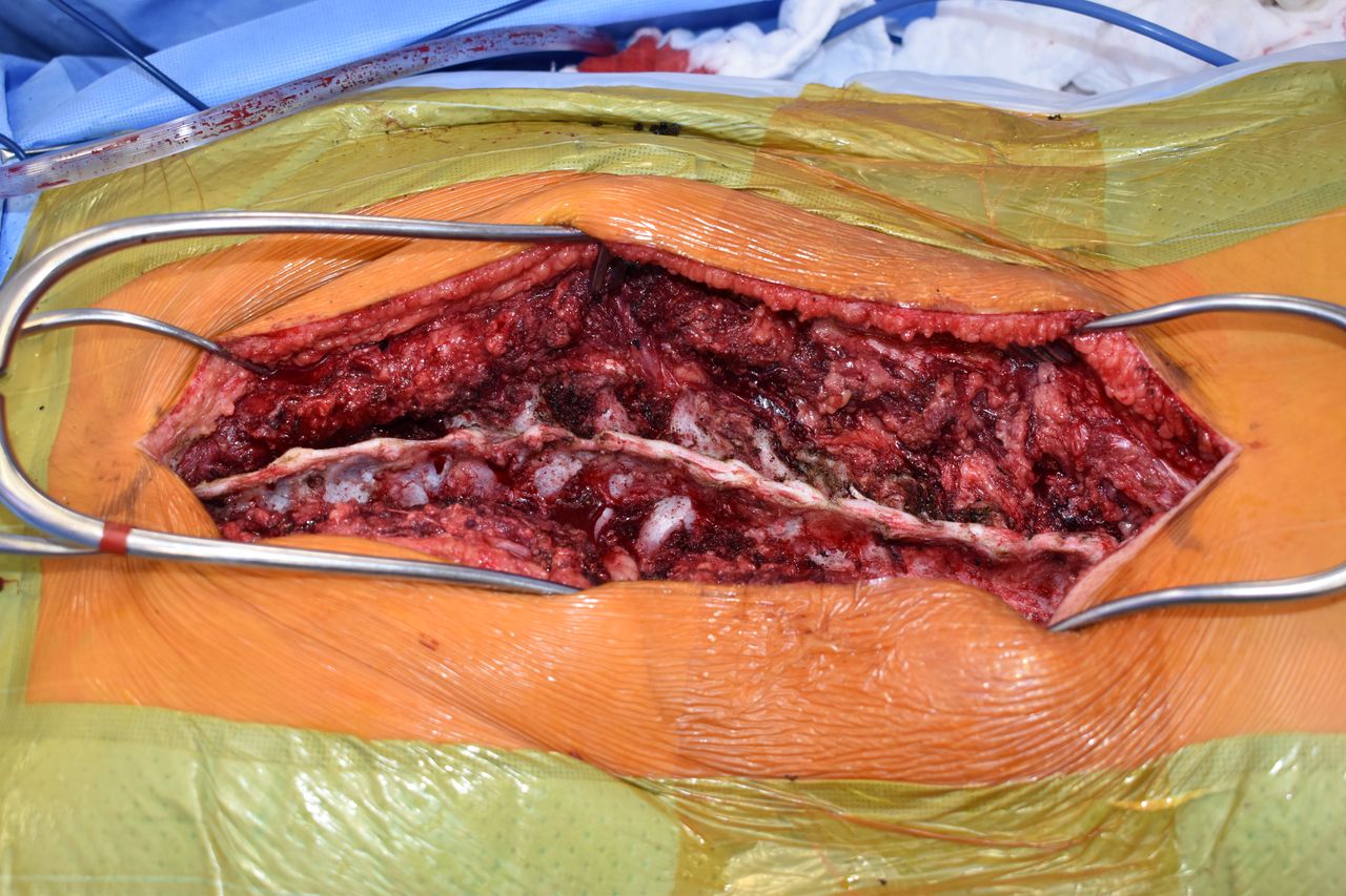 Jose Eduardo Larrinua Betancourt-7