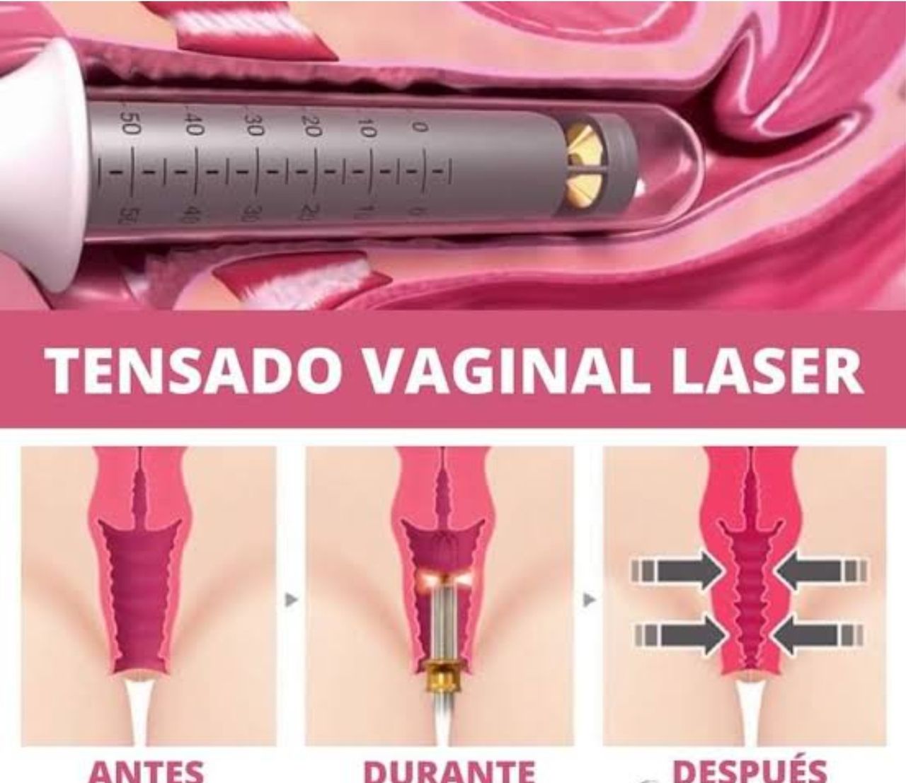 Marco Aurelio Corona Hernandez-3