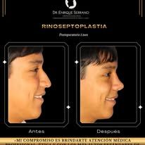 Enrique Serrano Cruz-7