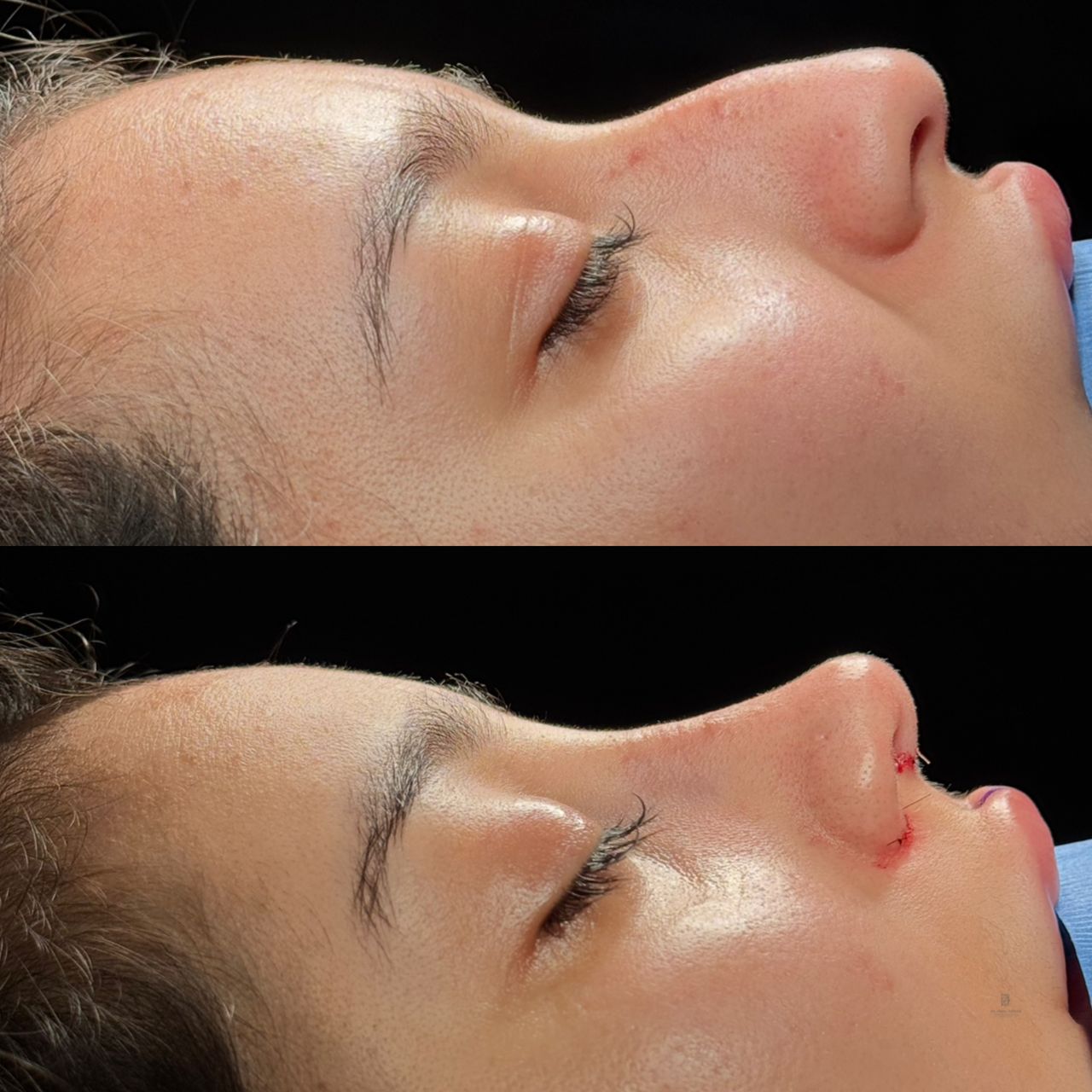 Angel Castro Urquizo-213