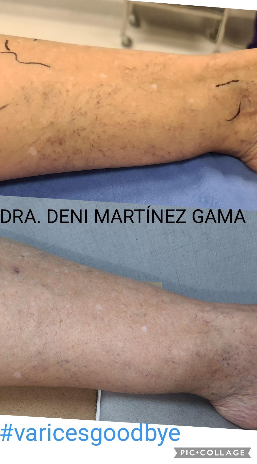 Deni Martínez Gama-7