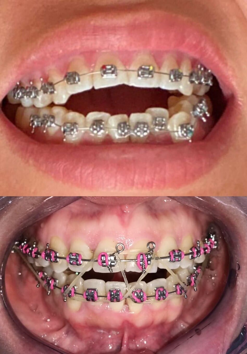 Luz Anel Valente Lozano-11