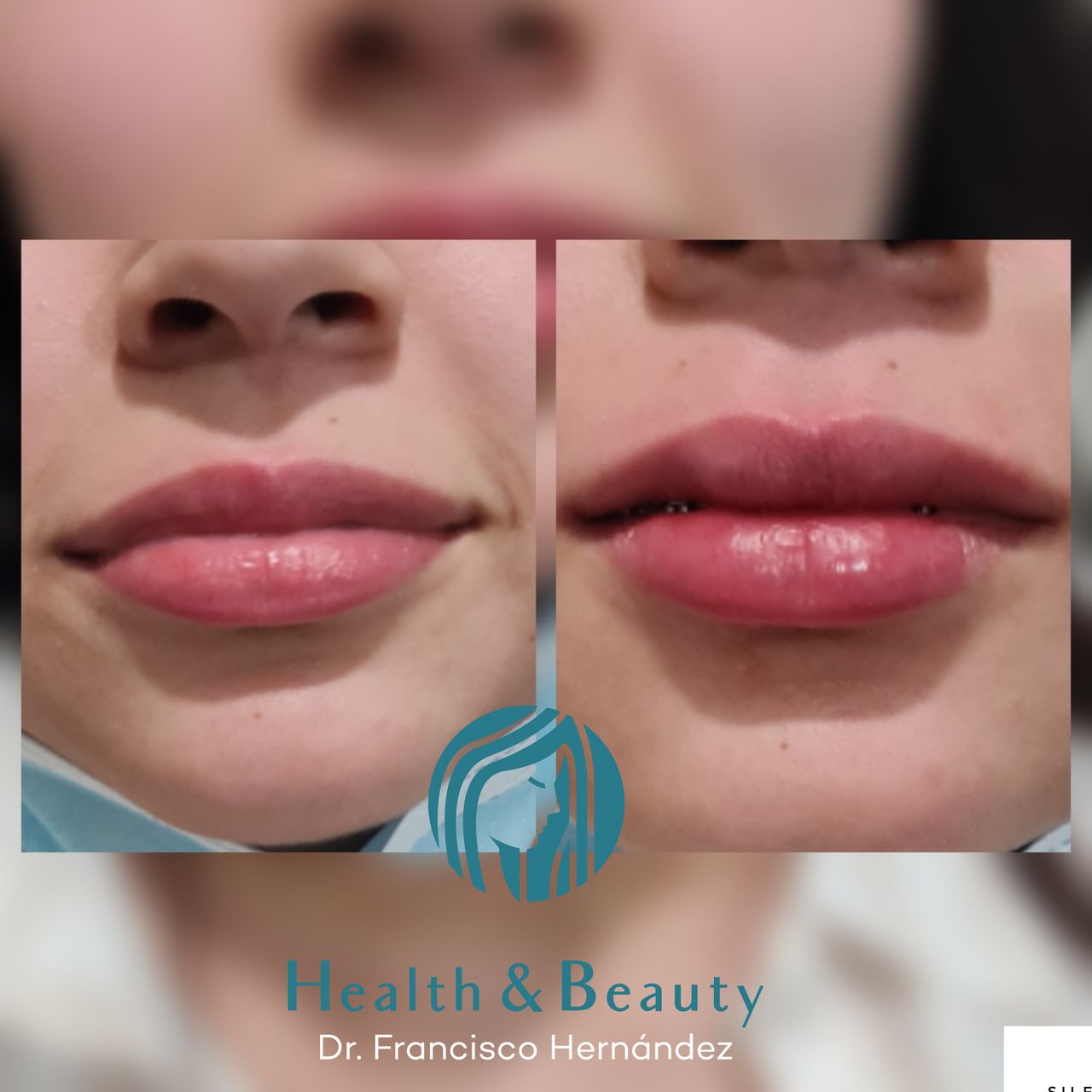 Francisco Hernández Gómez Crespo-192