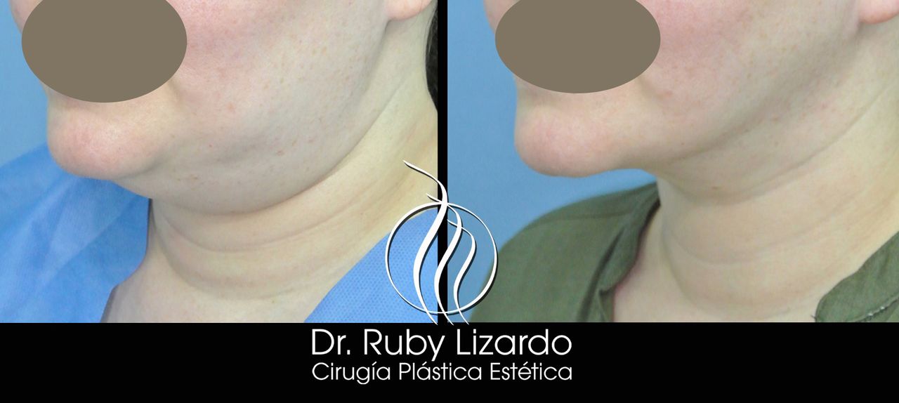 Ruby Lizardo Ramírez Robles-12