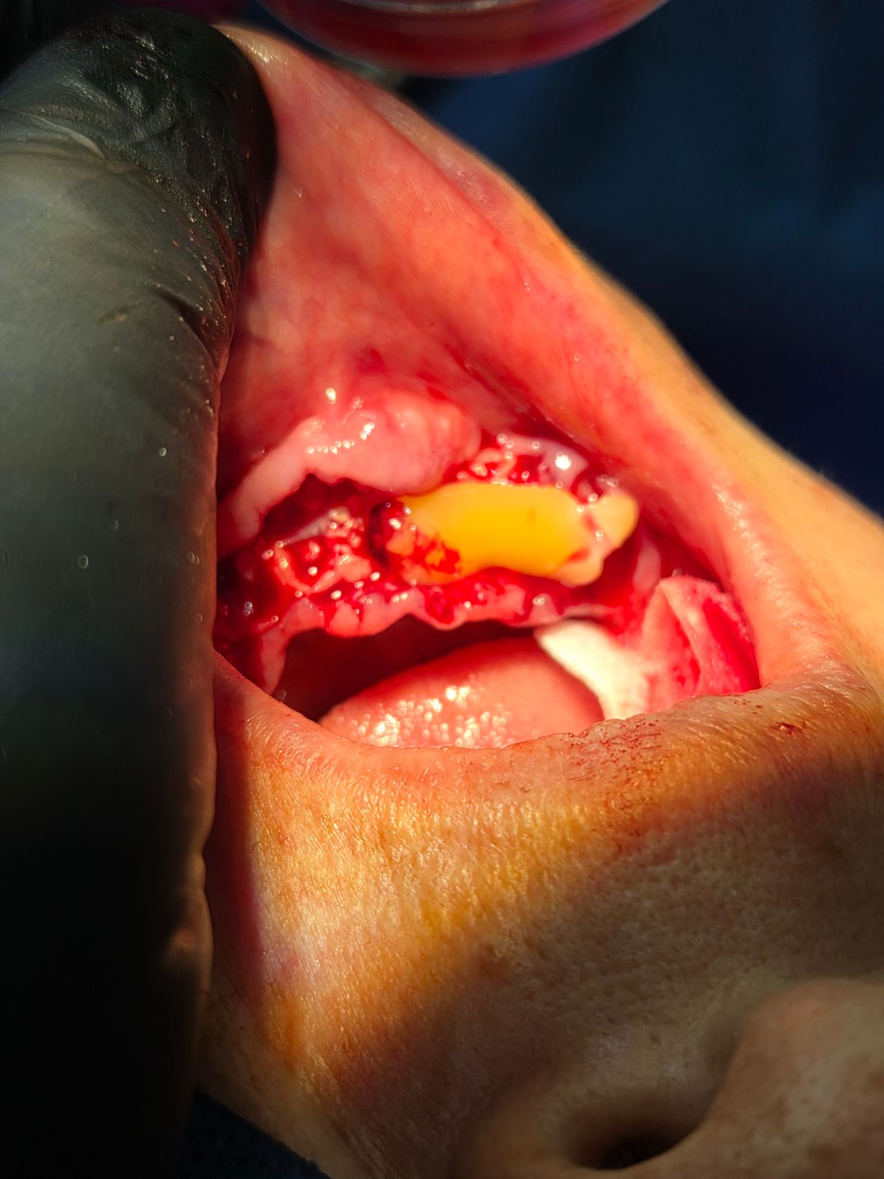 Verónica Nallely Gómez Mesa-1