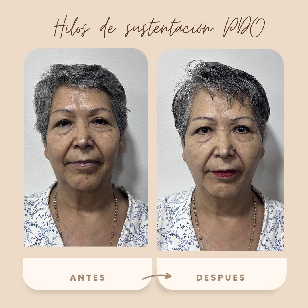 Sinue Hazael  Aguilar Hernández -5