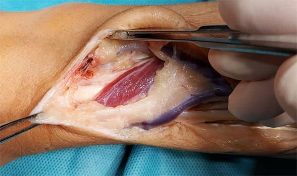 Alfredo Rebolledo Desales-1