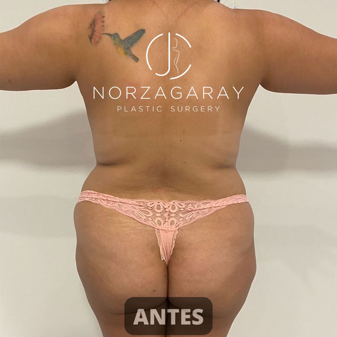 Juan Carlos Norzagaray-4