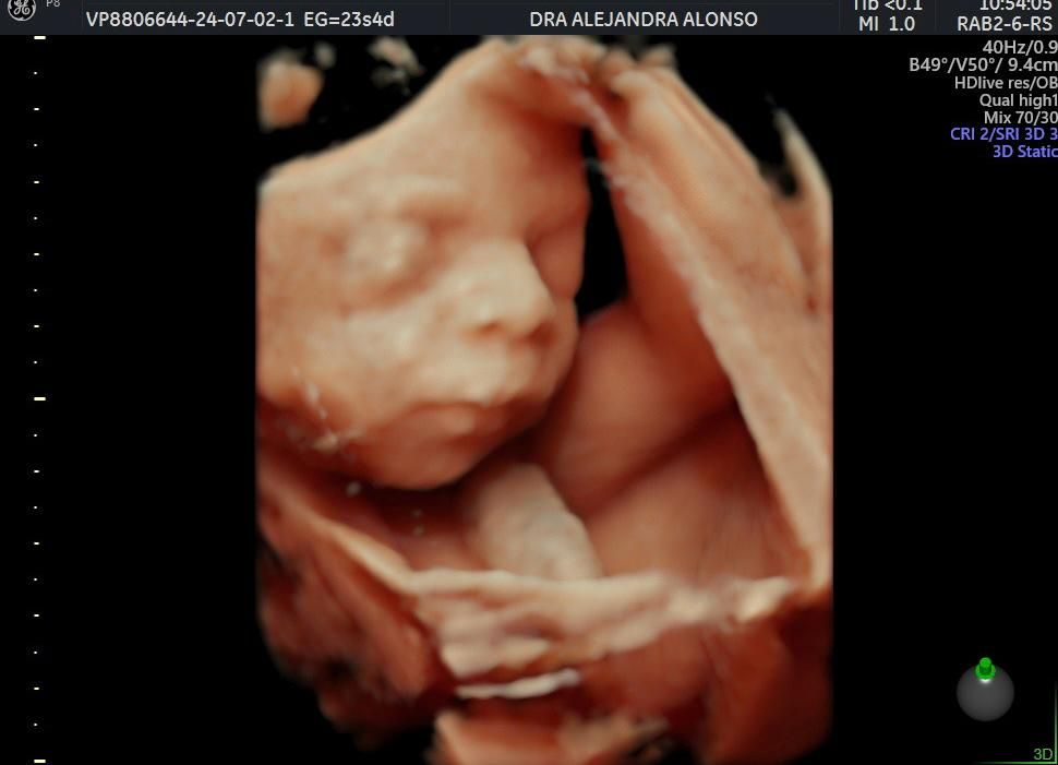 Alejandra Alonso Martínez-6