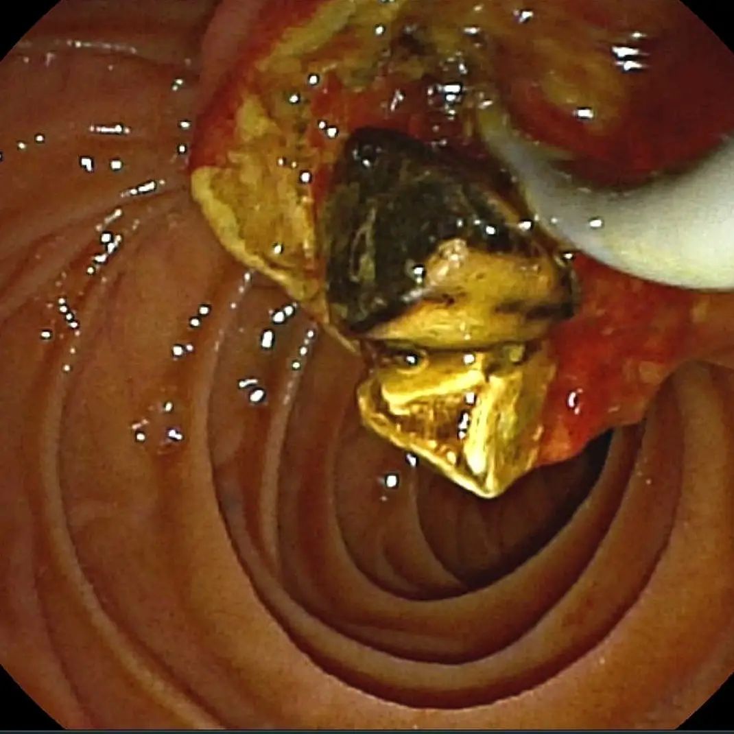 Edgar Alan De León Rojas-18