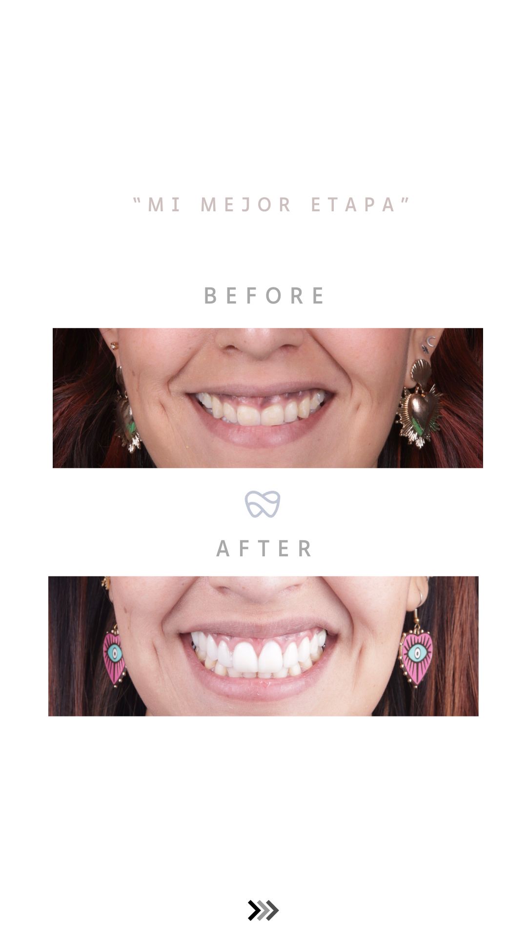 Erick Perea Santillán-3