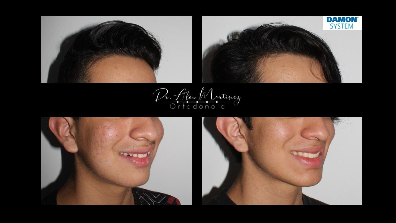 Alejandro Martínez Hernández-21