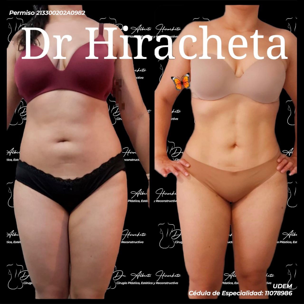 Alberto Hiracheta Torres-21