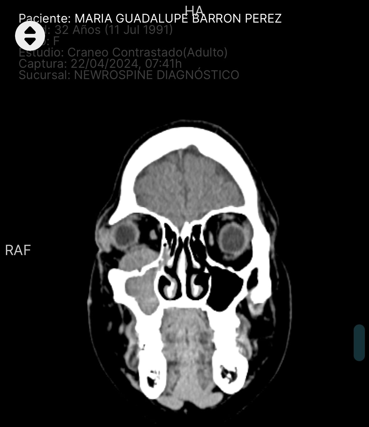 Erendalhi Rocha Mesta-6