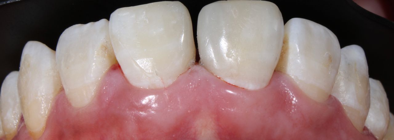 Hervin Eduardo Mendez Borrego-18