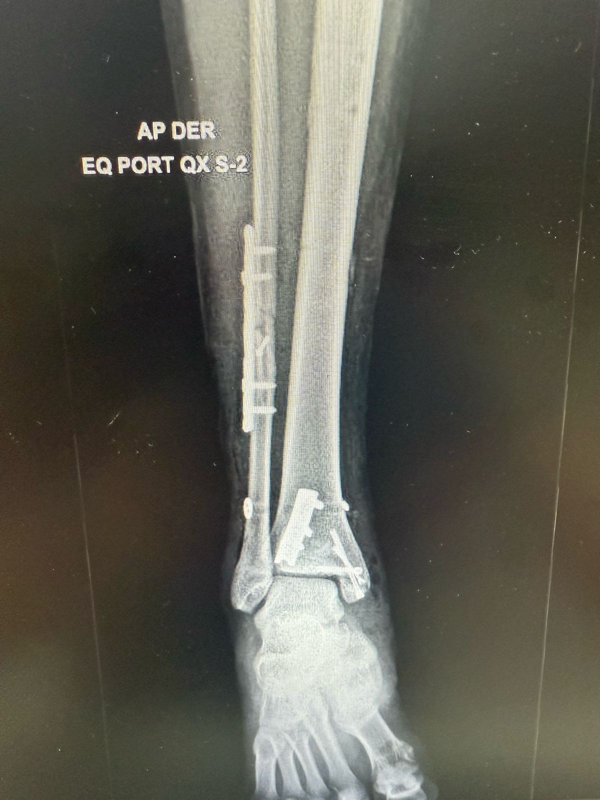 Juan Crisostomo De León Galindo-5